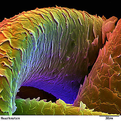 Hair Microscopy